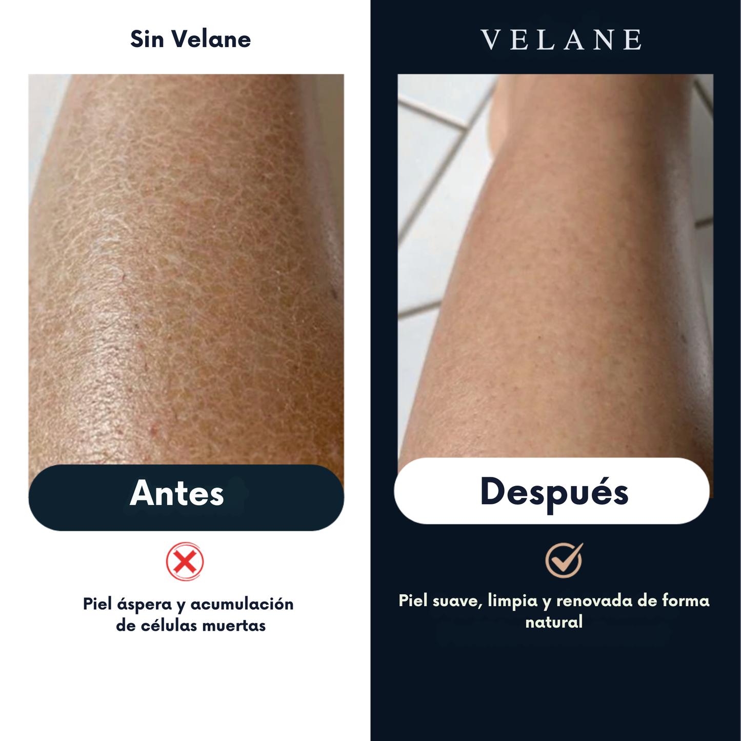 Toalla exfoliante Velane®