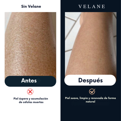 Toalla exfoliante Velane®