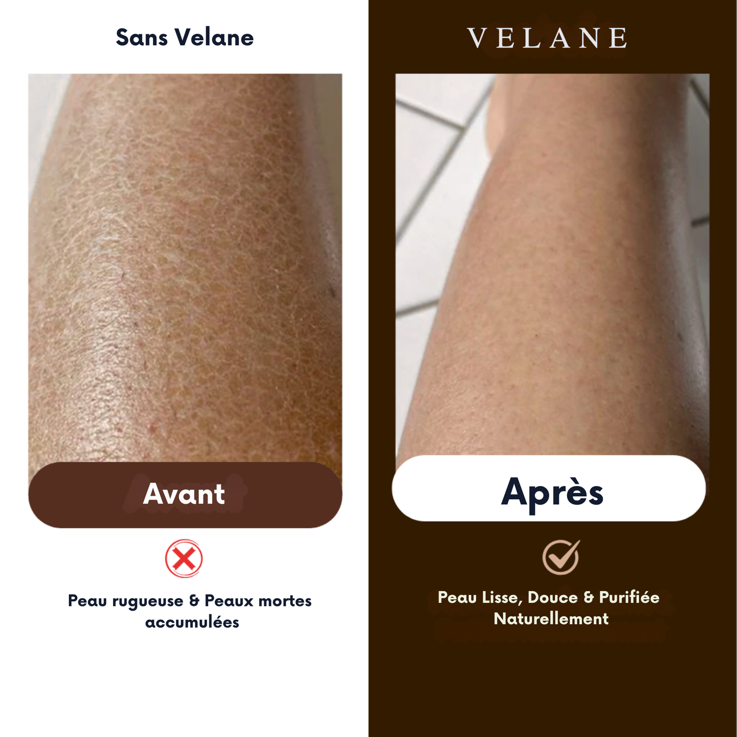 Serviettes exfoliante